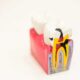 The Root Canal Debate: Risks & Alternatives